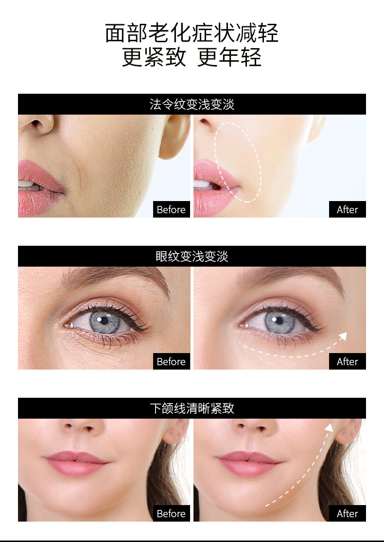 金稻（K-SKIN）射频美容仪器 热玛吉第五代 家用美容院脸部按摩仪 眼部美眼仪光子嫩肤仪 KD9902