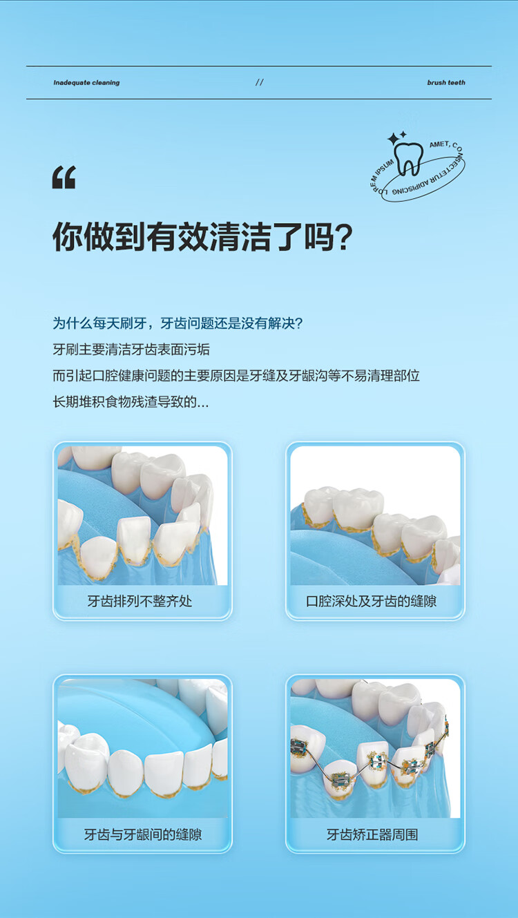 美的（Midea）冲牙器洗牙器水牙线洗牙神器洁牙器 小蓝鲸便携式电动正畸冲牙器家用 MC-BJ0101