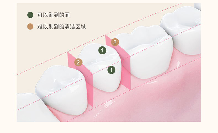 素士 SOOCAS 便携冲牙器 高频脉冲 水牙线 洗牙器 立式香氛洁牙器 W3F玫瑰粉