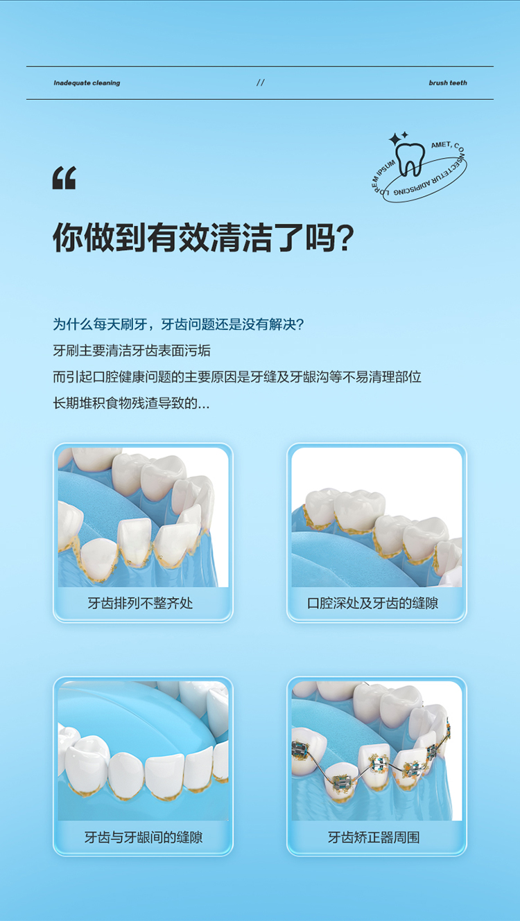 美的（Midea）冲牙器（小蓝鲸）冲牙器 洗牙器 水牙线 预防牙结石 家用便携 MC-BJ0101