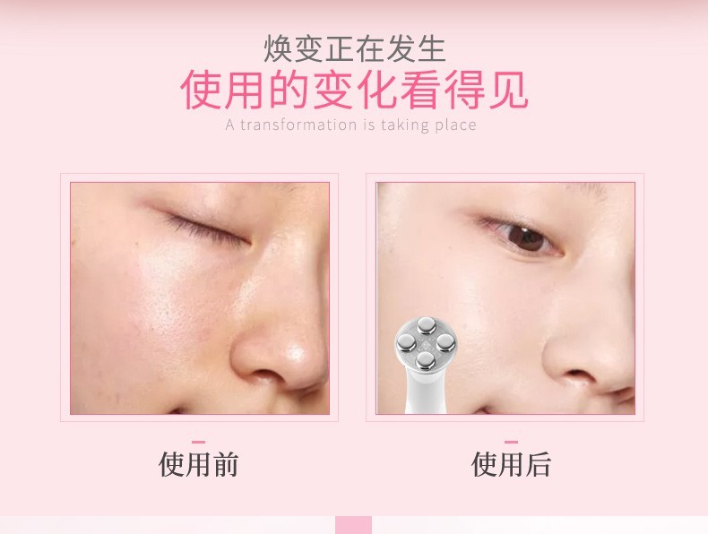 金稻（K-SKIN）美容仪 射频超声波精华导入仪面部提拉淡皱去纹 光子嫩肤家用脸部按摩仪KD9900 【白色】
