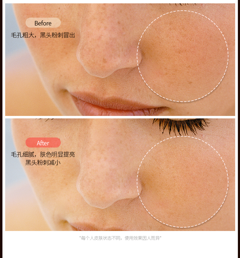 金稻（K-SKIN）家用精华导入仪 美容仪器 脸部家用 面部嫩肤仪 KD9960充电白色