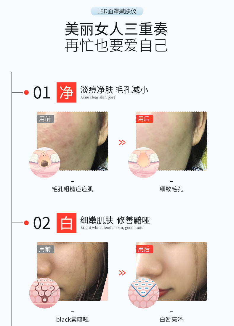 金稻 美容仪家用脸部面膜光子嫩肤导入面部红光红蓝光led彩光电子面罩 KD036