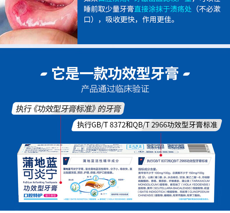 蒲地蓝可炎宁牙膏口腔特护留兰味改善牙龈健康 抑制牙菌斑 缓解牙周口腔异味100g