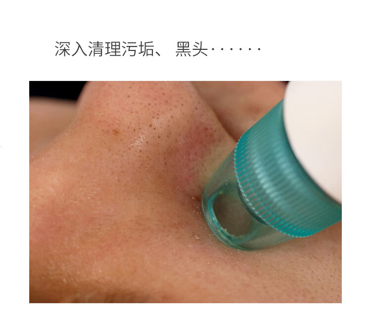 金稻（K-SKIN）黑头仪便携 家用 KD-802 黑头吸出器 真空去黑头毛孔清洁 去黑头