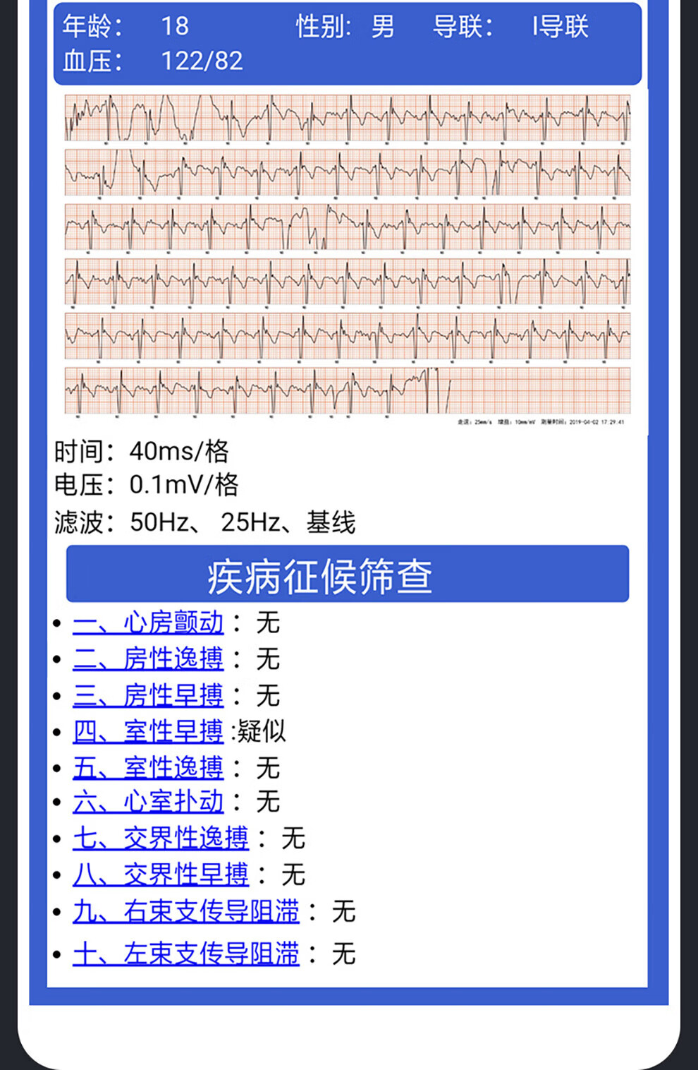 纽曼（Newsmy）血压智能手环 W10 精准心率血压血氧检测睡眠体温监测 防水运动男女测量
