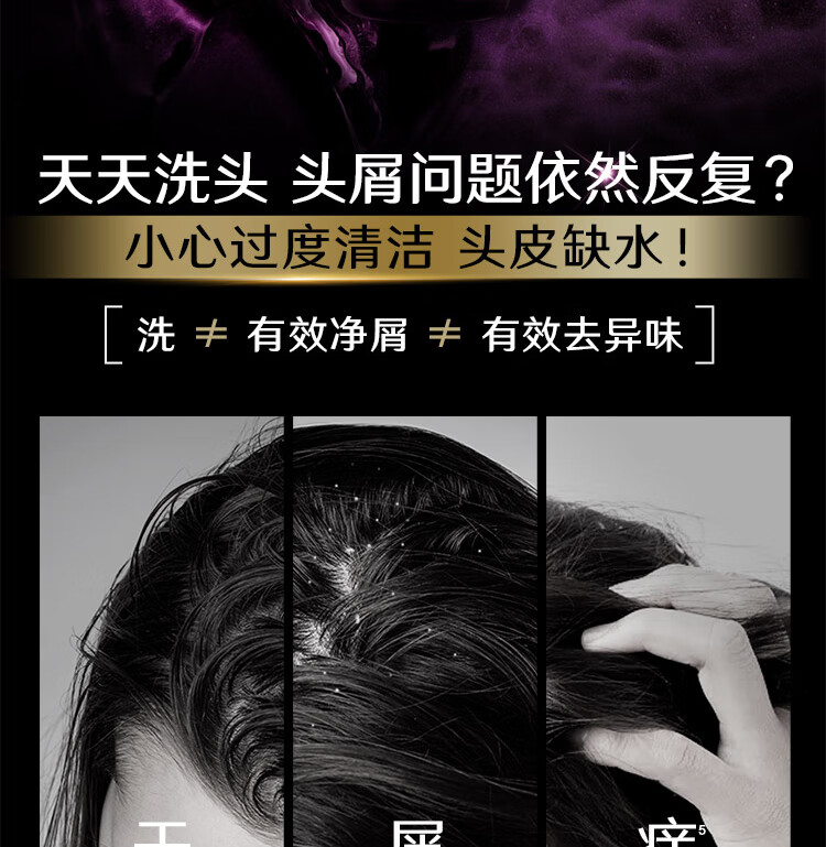 清扬去屑头皮护理洗发露 多效水润养护型白瓶205g新老包装随机发货