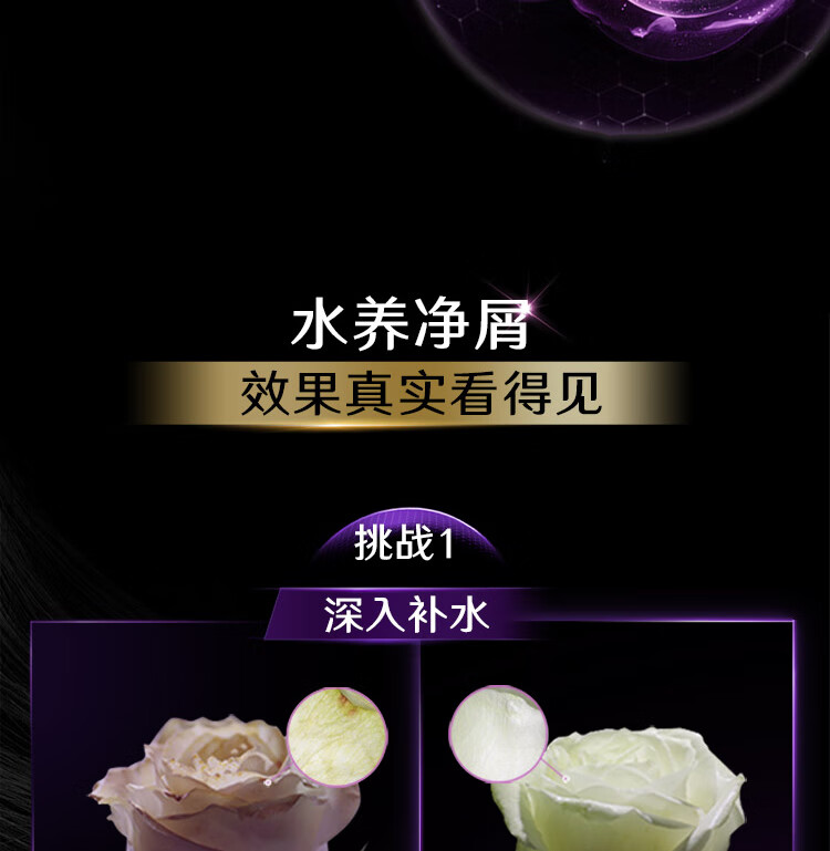 清扬 去屑头皮洗发露 多效水润养护型白瓶205g（新老包装随机发货）