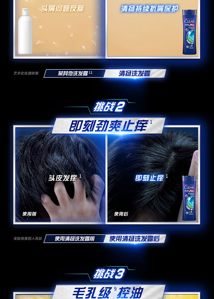 清扬 去屑洗发水套装 水润养护型(720*2+100*2)g（新老包装随机发货）