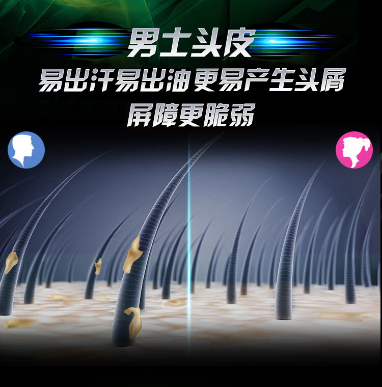 清扬男士头皮劲活专研去屑洗发露 劲爽控油型380g