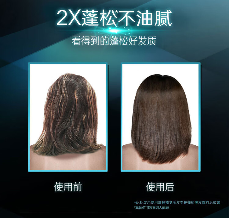 清扬 植觉头皮蓬松型电商组套 (380X2+100X2)g（新老包装随机发货）