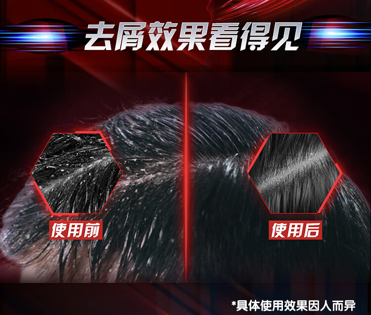 清扬 男士劲活专研去屑洗发露 劲爽控油型380g（新老包装随机发货）