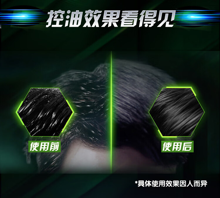 清扬 男士劲活专研去屑洗发露 劲爽控油型380g（新老包装随机发货）