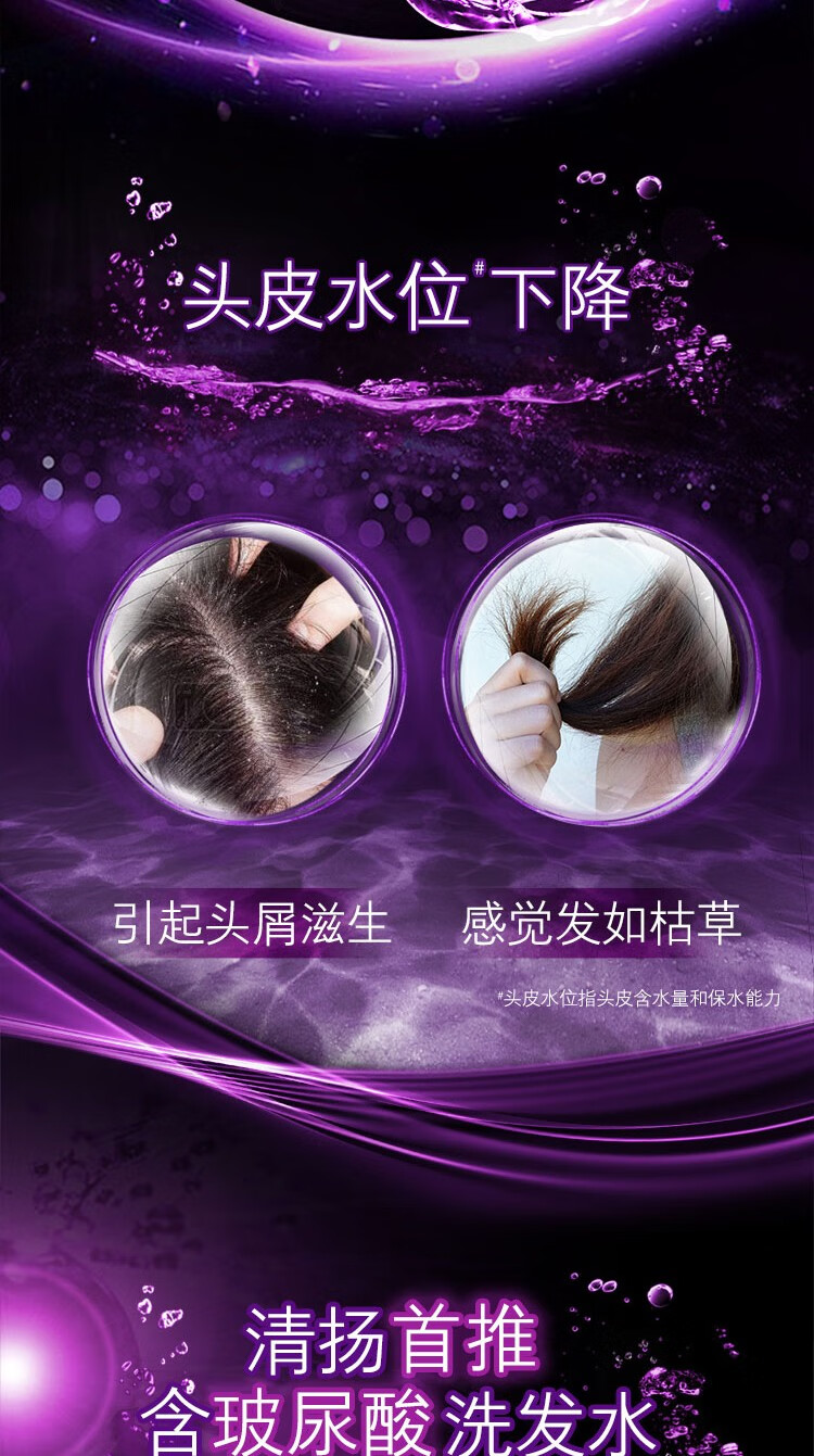 清扬 去屑头皮洗发露 多效水润养护型白瓶720g（新老包装随机发货）