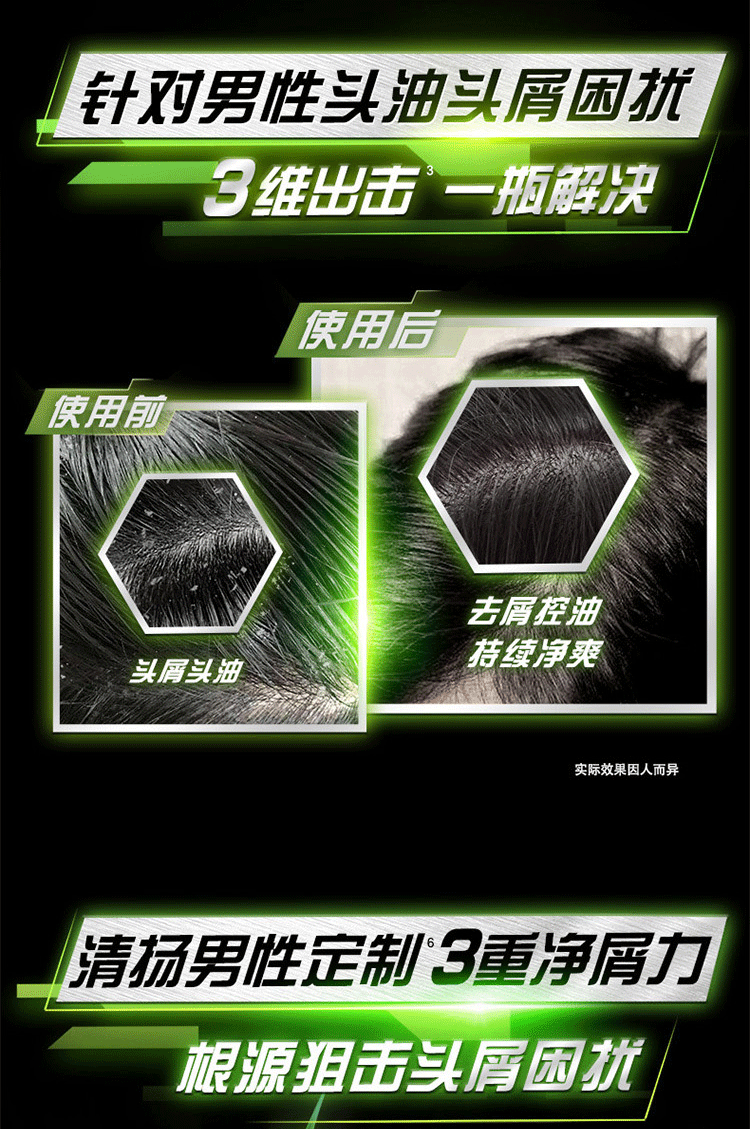 清扬 去屑洗发水套装 花露香型(720*2+100*2)g（新老包装随机发货）