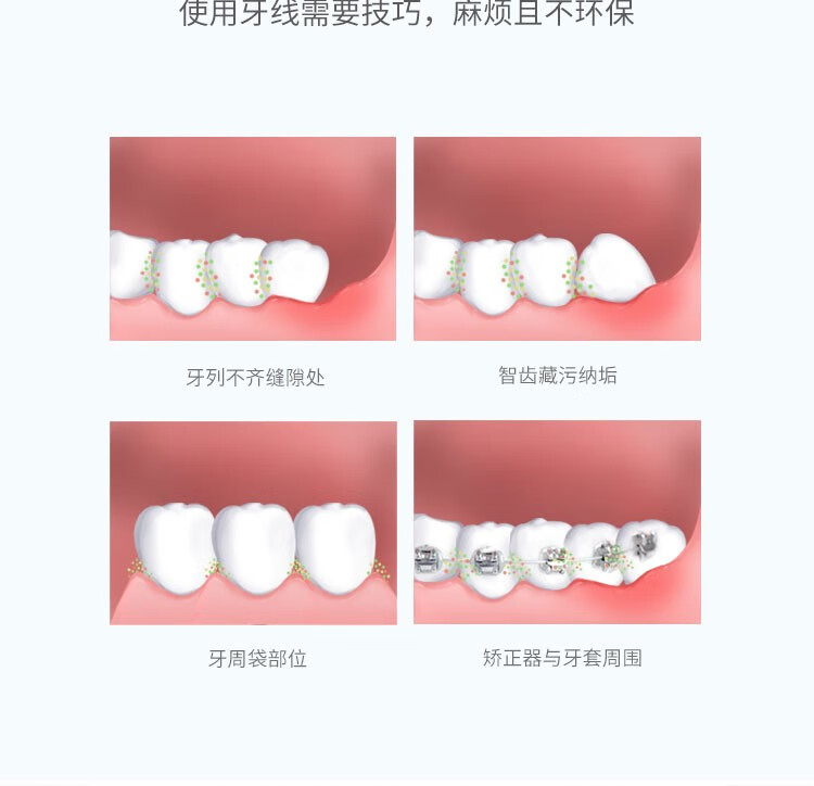 ROAMAN冲牙器家用HS8 深蓝色便携式口腔清洁洗牙器水牙线mini牙套正畸专用牙齿缝清洁 罗曼