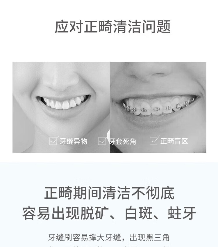 ROAMAN冲牙器家用HS8 深蓝色便携式口腔清洁洗牙器水牙线mini牙套正畸专用牙齿缝清洁 罗曼