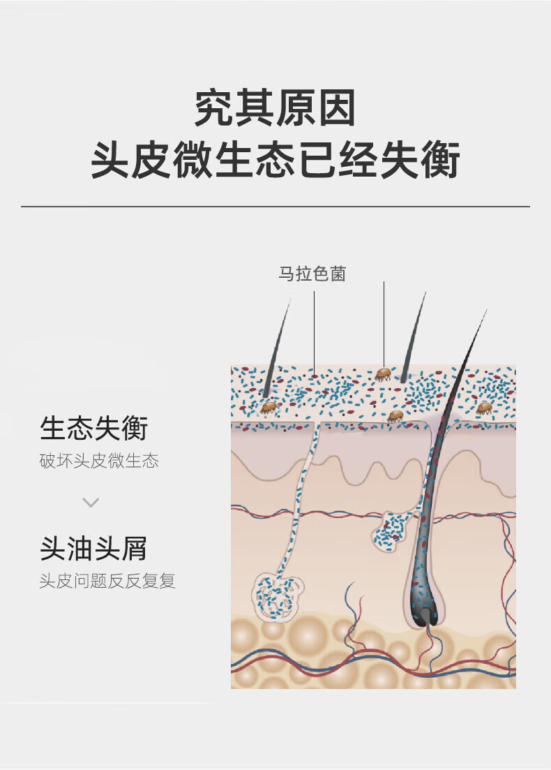 满婷 氨基酸表活男士净爽去屑洗发乳450ml